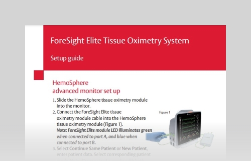 ForeSight tissue oximetry setup guide